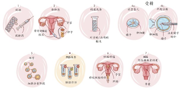 如何正确选择试管婴儿